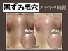 ２回目以降【美肌 毛穴レスコース】毛穴ケア＋白玉ピール(90分)