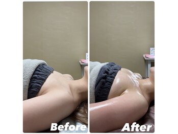 オンユ(Onyu)/ビフォーアフター2