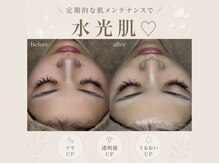 ベルスキン(Bell skin)の雰囲気（お肌メンテナンスから深いお悩みのお肌の根本改善まで♪）