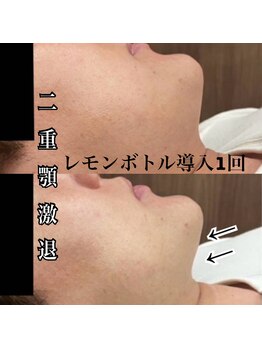 レジェンド(LEGEND)の写真/眉毛×小顔で第一印象をアップデート!清潔感溢れるイケメンへ。金沢駅5分の男磨き専門店。