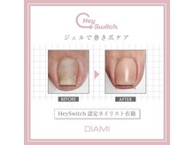 ネイルサロン ブランシュ(Nail Salon Blanche)の雰囲気（特殊なジェルを使って巻爪ケア★内側に巻いた爪を逆カール★）