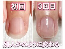 スターネイル(Starnail)/ジェルできない方ネイルケア育成