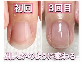 ジェルできない方ネイルケア育成