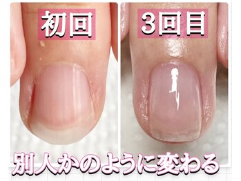 ジェルできない方ネイルケア育成