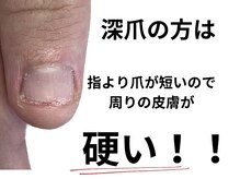 グレースレディ 神戸北店/