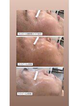 シャンディ(Shandy)/ラミピールでどんどんを変化中◎