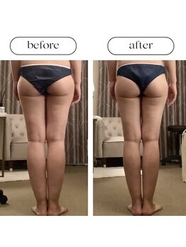 スラン(Slan)/足の引き締め