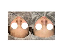 アデル 久留米(ADEL)の雰囲気（シェービングとは別格の違い◎潤艶フェイスワックス/フェイスWAX）