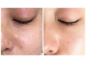 プリマプリート 島店/スノーピール