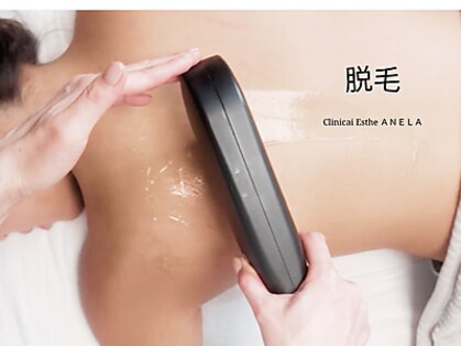 アネラ(ANELA)の写真