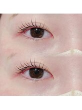 ビオラス(Biolus)/まつげパーマ/ラッシュリフト