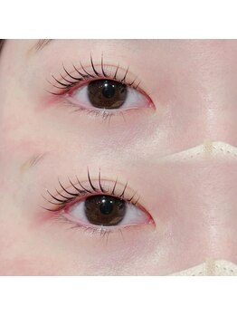 ビオラス(Biolus)/まつげパーマ/ラッシュリフト