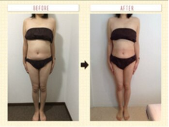 美容整体ウェリナ あま甚目寺院/小顔矯正/骨盤矯正/美脚サロン