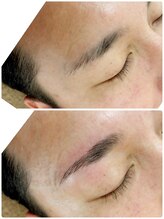 ウェルネスマルカ(wellness MARCA)/ハリウッドブロウリフト