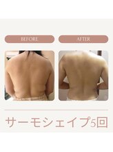 ユウキ(yuuki)/サーモシェイプ5回結果写真