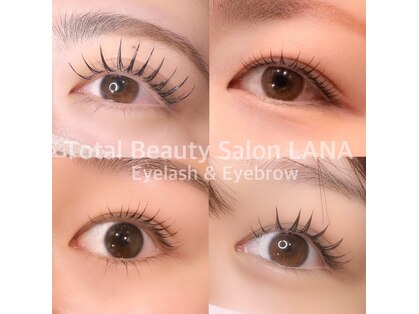 ラナ(Lana)の写真