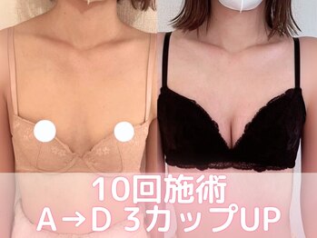 美人バスト 横浜店/バストアップ/育乳(10回施術)