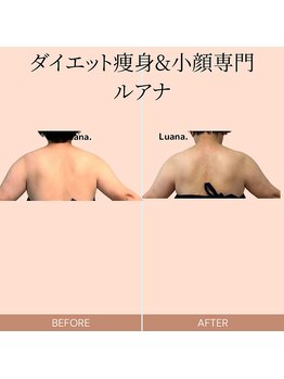 ルアナ(Luana.)/ダイエット痩身&小顔専門-ルアナ
