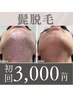 人気No1☆大人気◎【男性髭脱毛】最新THR脱毛☆剛毛に効果大◎結果重視