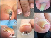 ネイルエイト 新百合ヶ丘(nail8)