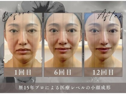 ゴールデンケア(goldencare)の写真