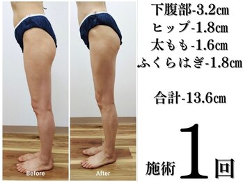 ルミエール 新宿御苑/本気やせ!長年の悩み解消!技術