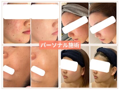 アンノン(Annon)の写真