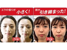 上大類整体院/小顔矯正