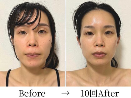 ビコツプロ(Bikotsu Pro)の写真