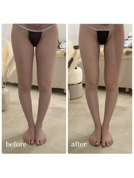 ヒューインディバサロン 横浜(HUE INDIBA SALON)の写真/頑張るだけのダイエットはもう終わり