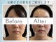 さくら鍼灸院 整骨院の写真/◎気になるほうれい線やお肌のたるみを改善へと導く丁寧なケア！エイジングケアでお肌の改善をご提案◎