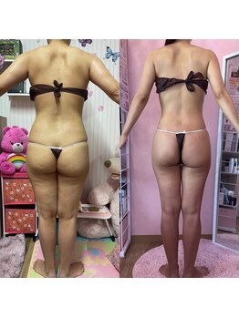 ポノ(Pono)/【痩身】産後/バックアングル