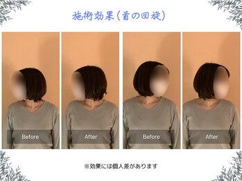 ボディ リセット アンド デザイン(Body Reset & Design)/【施術例】ビフォーアフター
