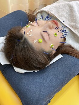 ふたば整骨院 中島公園院/美容鍼灸