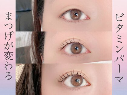 リープ(liip)の写真