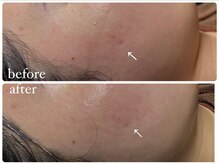 ビノスビューティー(vinos.beauty)/ReLABEAUTEハーブトリートメント