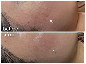 ビノスビューティー(vinos.beauty)/ReLABEAUTEハーブトリートメント