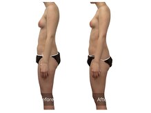 ベンザイ 新潟店(BENZAI)/ストレートネックは下垂の元