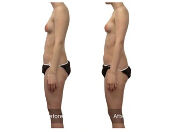 ベンザイ 新潟店(BENZAI)/ストレートネックは下垂の元