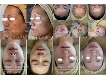 キュアリード(Cure_Lead)