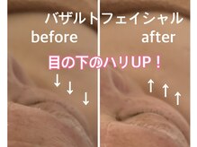 フルール エンビロン(フルール ENVIRON)/凝り固まった表情筋がふっくら