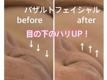 フルール エンビロン(フルール ENVIRON)/凝り固まった表情筋がふっくら