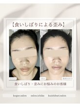 イチカ 仙川店( ichika)/食いしばりによる歪み左右差