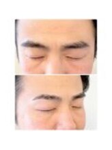 アイビー 神保町店(i.b)/眉【Before⇒after】３７