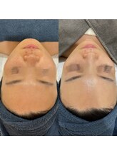 ラ クレール ビューティーサロン(LA CLAIR)/ララピール×LDM再生×LED管理