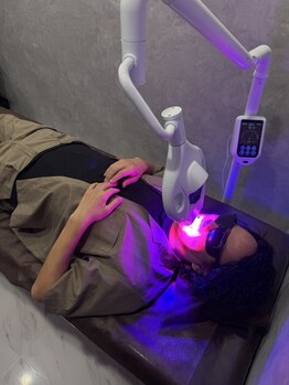 トミー(TOMMY)/セルフホワイトニング