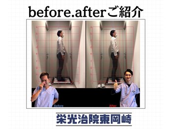 栄光治院 整体院東岡崎/デスクワーカーの猫背増えてる