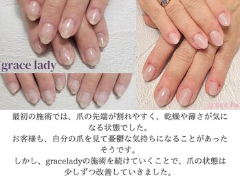 グレースレディ 神戸北店/