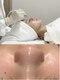 リジュベネ(rejuvena)の写真/艶肌ピーリングで効果アップ！保湿美容液で洗う本気の毛穴洗浄