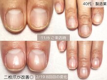 エヌプラス(Nplus)の雰囲気（二枚爪もこの通り◎体の内側からのアドバイスもおまかせください）